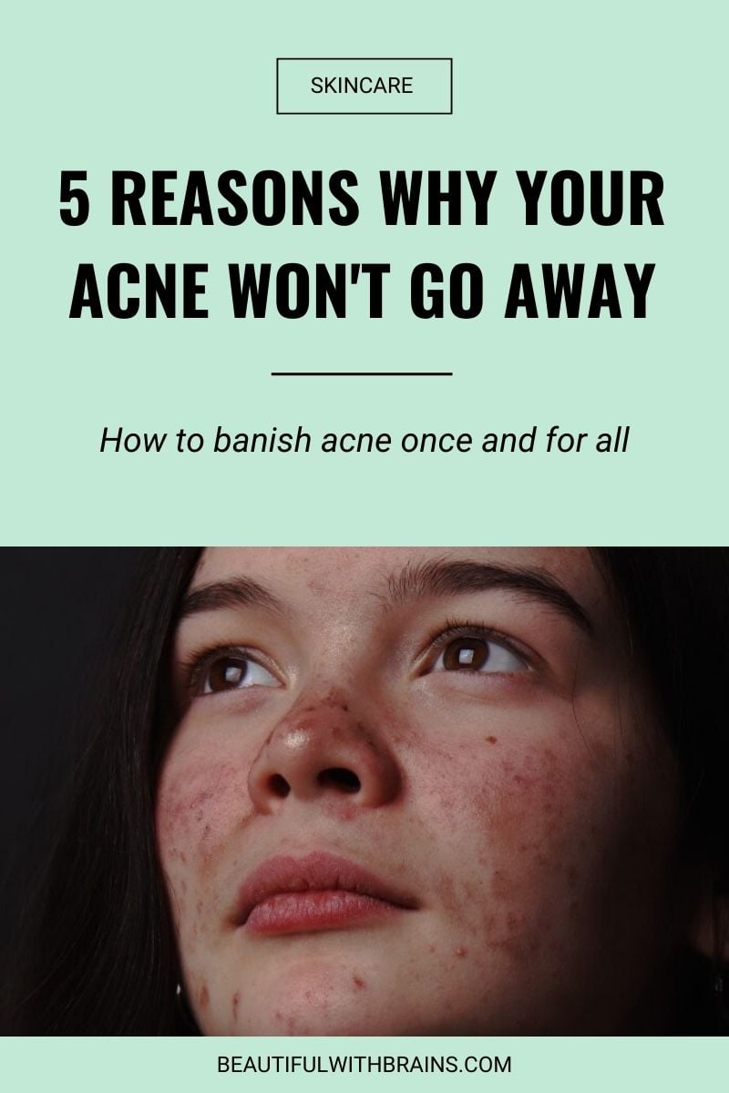 acne won't go away