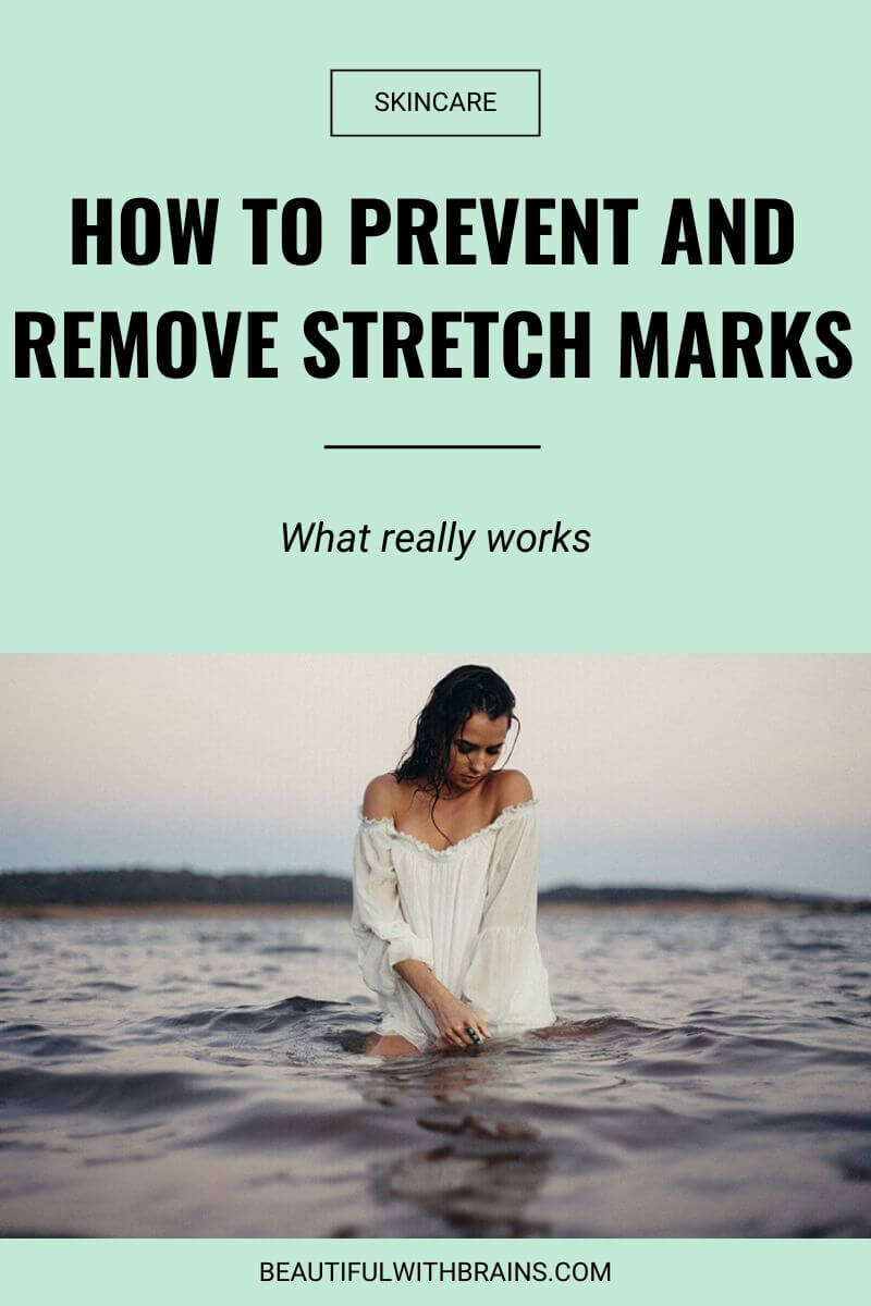 best stretch marks removal treatments