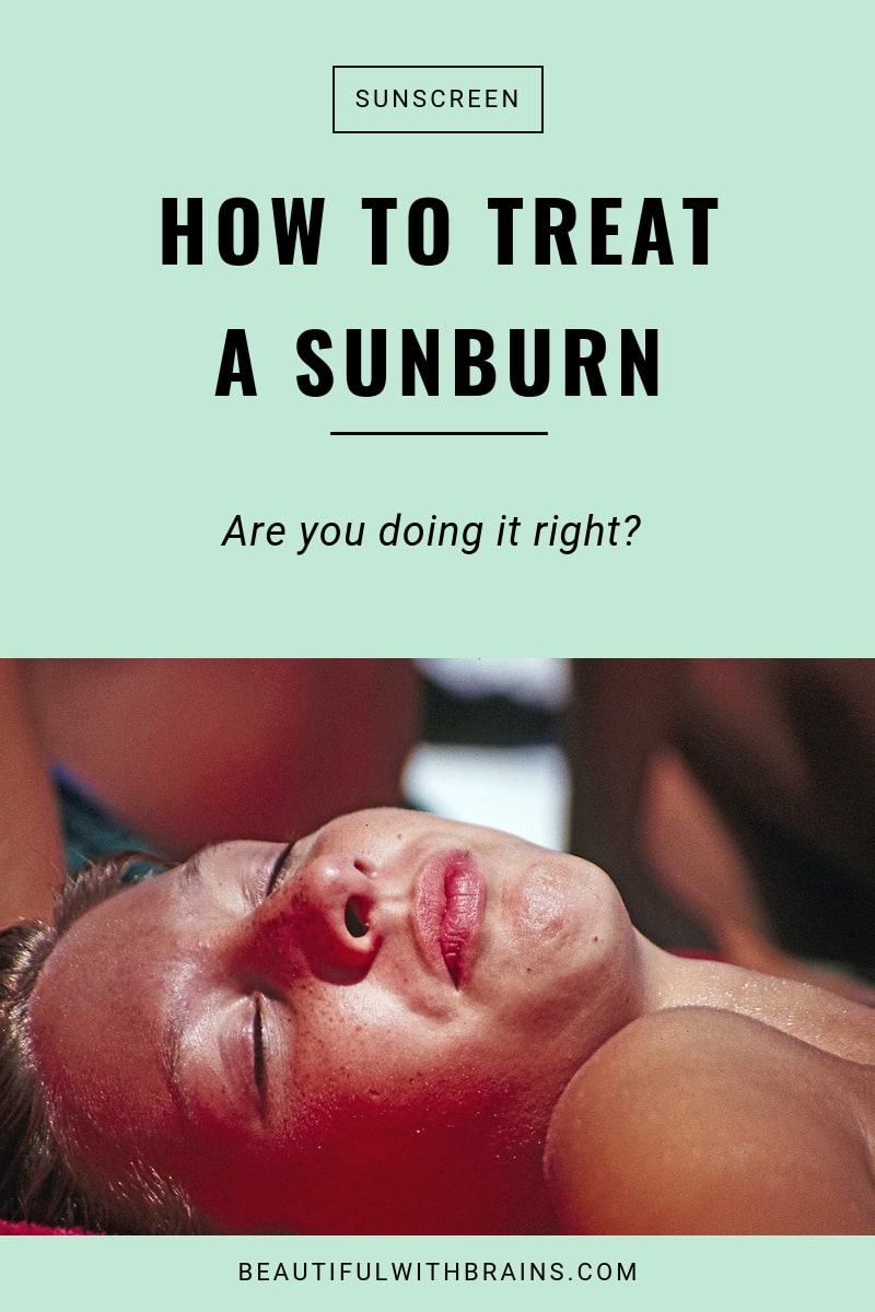 How to treat sunburns the right way