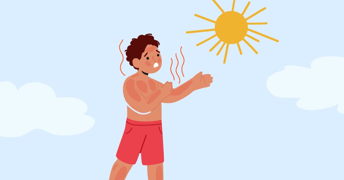 Recovering After a Sunburn Banner