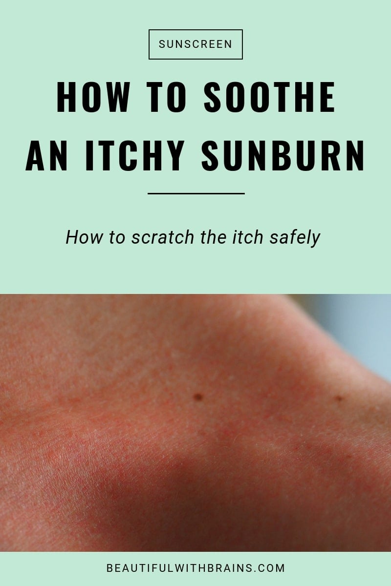 why sunburns itch + how to soothe them